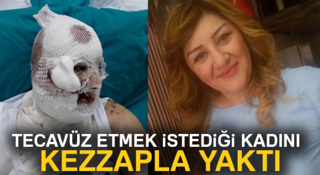 Tecavüz etmek istediği Azeri kadını kezzap ile yaktı